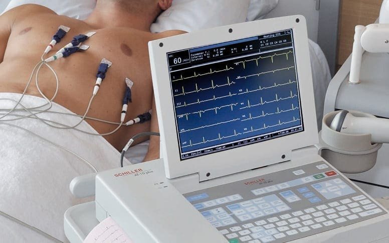 ECG - Électrocardiogramme